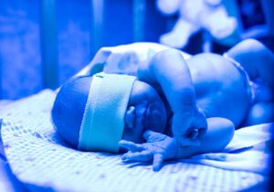 Через сколько проходит желтушка у новорожденных