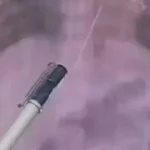 За скільки часу голка доходить до серця: міф розвінчано