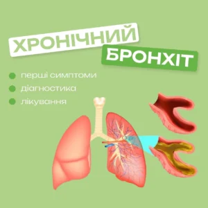 Чим лікувати бронхіт: доказовий підхід до відновлення дихання
